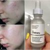 oil Control, Pore Minimizing & Blemish Solution Serum
